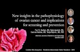 Fisiopatologia do Câncer de Ovários - Apresentação de artigo - New insights in the pathophysiology of ovarian cancer