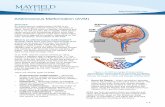 Arteriovenous Malformation (AVM) - Mayfield Clinic