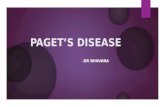 Signs in Paget’s disease