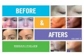 Before & After photos - Rodan + Fields - the truth shows its face.