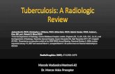 Tuberculose pulmonar e extrapulmonar- Aspectos radiológicos