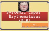 Systemic lupus