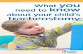 What You Need to Know About Your Child's Tracheostomy