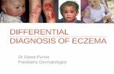 differential diagnosis of eczema