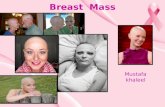 Breast mass (bening breast disease)