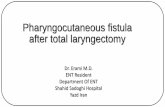 Pharyngocutaneous fistula after total laryngectomy Dr. M. Erami