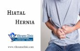 Hiatal Hernia Treatment In Chennai | Laparoscopic Surgery In India