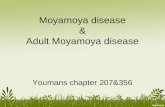 207&356 moya moya &adult moyamoya disease