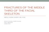 Fractures of the Middle third of the Facial Skeleton