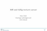MR ved tidlig rectum cancer