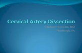 Arterial Dissection