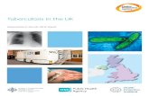 Tuberculosis in the UK: 2012 report