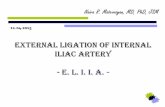 External Ligation of Internal Iliac Artery (E.L.I.I.A) - by Naira R. Matevosyan