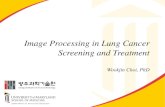 Image processing in lung cancer screening and treatment