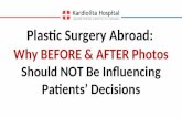 Plastic Surgery Abroad: Why Before And After Photos Should Not Be Influencing Patients’ Decisions