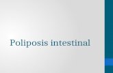 Poliposis intestinal