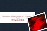 Photodynamic therapy in treatment of oral lichen planus: Dr Aparna