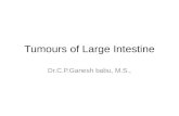 Tumours of large intestine