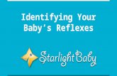 Identifying Your Baby's Reflexes