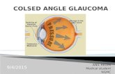 Colsed angle glaucoma