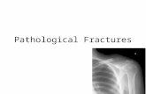 Pathological fractures