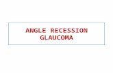 Angle recession glaucoma