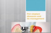 Peri implant Diseases and its management