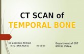 Ct scan temporal bone Dr Zeeshan Ahmad