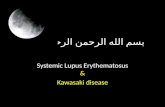 Systemic lupus erythematosis & Kawasaki disease