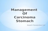Carcinoma Stomach Treatment