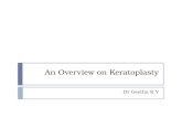 Keratoplasty overview