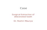 Surgical extraction of dilacerated tooth