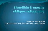 Mandible and maxilla oblique radiography