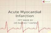 Atlas myocardialinfarction
