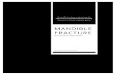 Mandible Fracture