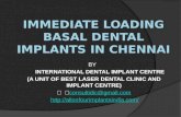 Immediate loading basal dental implants in chennai
