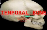 Temporal Bone and Facial Nerve Anatomy