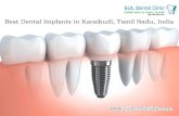 Best Dental Implants in Karaikudi Tamil Nadu India