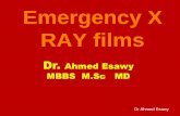 Emergency x ray films Dr Ahmed Esawy