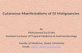 Cutaneous Manifestations of GI Malignancies