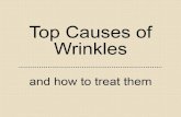 Causes of Wrinkles