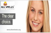 Invisible Braces in Bangalore | Clear Braces Cost in India