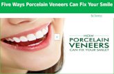 Five ways porcelain veneers can fix your smile by Dentzz
