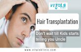 Hair Transplantation In Bangalore | Treatment For Hair Loss In India