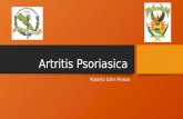 Artritis psoriasica