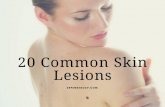 20 Common Skin Lesions