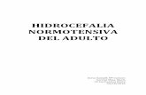(2016-10-04)Hidrocefalia normotensiva del adulto (DOC)