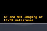 CT and MRI Imaging of Hepatic metastases