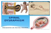 Imaging of spinal dysraphism