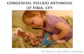 Congenital pseudo arthrosis of tibia